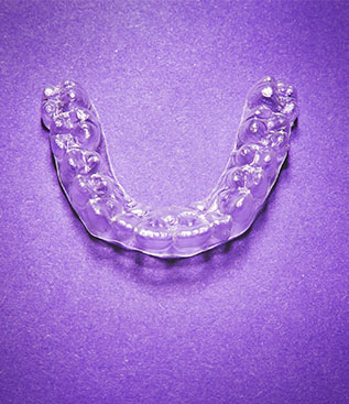 Tooth Whitening Smiles Dentist's Selsdon