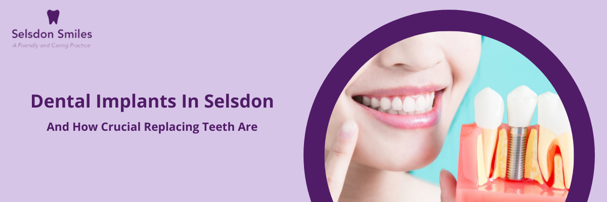 Dental Implants in Selsdon